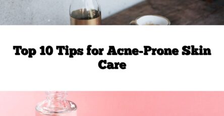 Top 10 Tips for Acne-Prone Skin Care